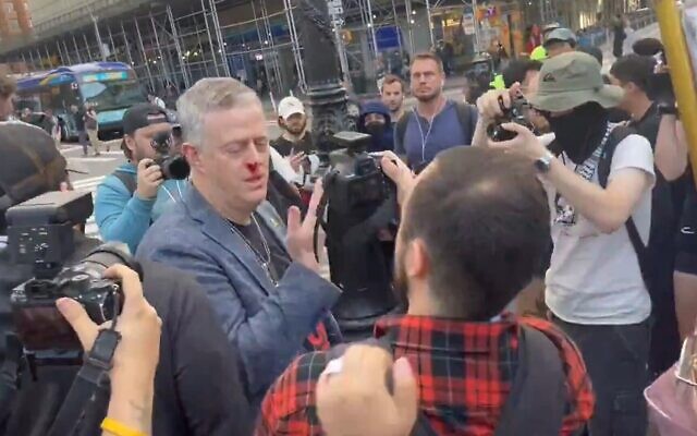 Todd Richman, président de la Majorité démocratique d'Israël saignant après avoir été attaqué par des manifestants pro-palestiniens et anti-Israël à New York, le 7 octobre 2024. (Crédit : Capture d'écran/X ; utilisée conformément à la clause 27a de la loi sur les droits d'auteur) Todd Richman, président de la Majorité démocratique d'Israël saignant après avoir été attaqué par des manifestants pro-palestiniens et anti-Israël à New York, le 7 octobre 2024. (Crédit : Capture d'écran/X ; utilisée conformément à la clause 27a de la loi sur les droits d'auteur)