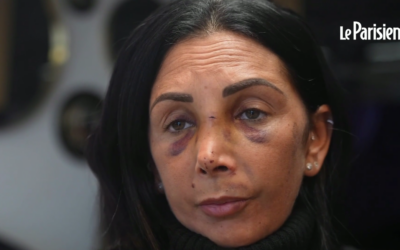 Séverine, opticienne du centre commercial Les Flanades à Sarcelles, victime d'une violence agression le 18 novembre 2024, dans une interview publiée par Le Parisien, le 20 novembre 2024. (Crédit : Capture d'écran Le Parisien ; utilisée conformément à l'article 27a de la loi sur le droit d'auteur)