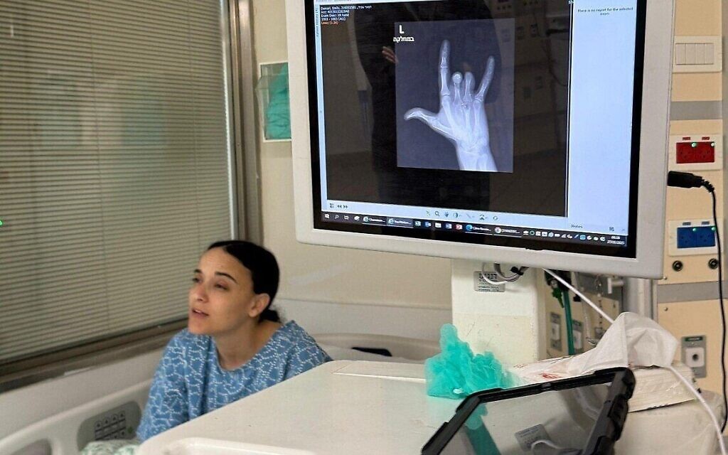 Emily Damari, avant une opération de la main gauche le 2 mars 2025, après avoir été blessée par balle le 7 octobre 2023 et n'avoir pas reçu de soins médicaux appropriés pendant ses 15 mois de captivité entre les mains du Hamas à Gaza (Crédit : Pomi Ofi Tal)
