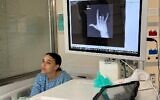 Emily Damari, avant une opération de la main gauche le 2 mars 2025, après avoir été blessée par balle le 7 octobre 2023 et n'avoir pas reçu de soins médicaux appropriés pendant ses 15 mois de captivité entre les mains du Hamas à Gaza (Crédit : Pomi Ofi Tal)