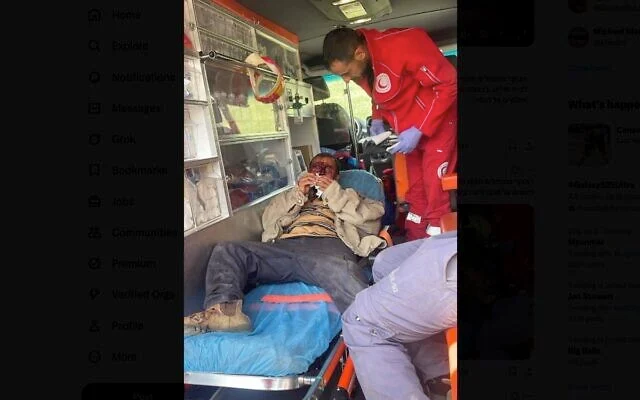 Un berger palestinien blessé lors d'une attaque présumée par des résidents d'implantations israéliens dans le sud de la Cisjordanie, le 28 mars 2025. (Au-delà du troupeau/X) Un berger palestinien blessé lors d'une attaque présumée par des résidents d'implantations israéliens dans le sud de la Cisjordanie, le 28 mars 2025. (Au-delà du troupeau/X)