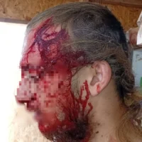 Une photo publiée par un groupe militant de résidents d'implantations montrant la victime d'une attaque présumée de Palestiniens en Cisjordanie le 13 mars 2025. (Autorisation : groupe WhatsApp des implantations de collines)
