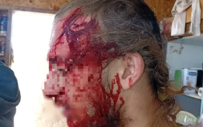 Une photo publiée par un groupe militant de résidents d'implantations montrant la victime d'une attaque présumée de Palestiniens en Cisjordanie le 13 mars 2025. (Autorisation : groupe WhatsApp des implantations de collines)