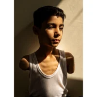 Cette image fournie par World Press Photo et prise par Samar Abu Elouf, pour le New York Times, a remporté le prix World Press Photo de l'année et montre Mahmoud Ajjour, 9 ans, qui a été blessé lors d'une attaque israélienne sur Gaza Gaza City en mars 2024 et qui a trouvé un refuge et une aide médicale à Doha, au Qatar, le 28 juin 2024. (Crédit : Samar Abu Elouf, pour le New York Times/World Press Photo via AP)