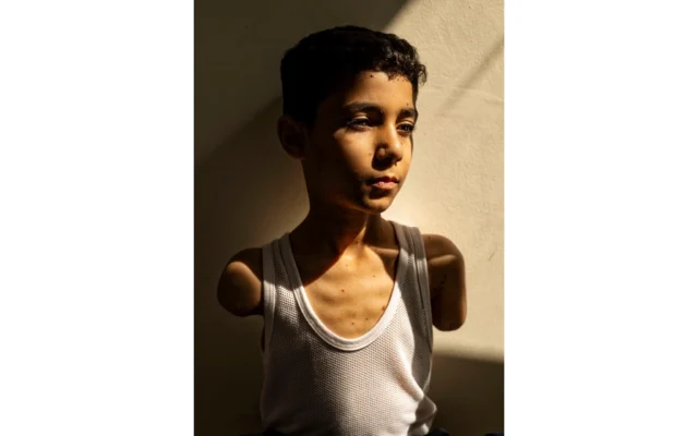 Cette image fournie par World Press Photo et prise par Samar Abu Elouf, pour le New York Times, a remporté le prix World Press Photo de l'année et montre Mahmoud Ajjour, 9 ans, qui a été blessé lors d'une attaque israélienne sur Gaza Gaza City en mars 2024 et qui a trouvé un refuge et une aide médicale à Doha, au Qatar, le 28 juin 2024. (Crédit : Samar Abu Elouf, pour le New York Times/World Press Photo via AP)