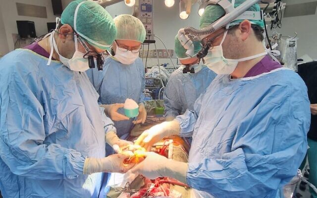 Le Dr. Avi (Jeff) Morgan (à droite) retirant le cœur du patient avant de le remplacer par un cœur artificiel, le 29 mai 2025. (Crédit : Porte-parole de l’hôpital Sheba)