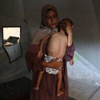 Hidaya, une mère palestinienne de 31 ans, berce son fils Mohammed al-Mutawaq, âgé de 18 mois et malade, qui présente également des signes de malnutrition, dans leur tente du camp de réfugiés d'Al-Shati, à l'ouest de Gaza-City, le 24 juillet 2025. (Crédit : Omar AL-QATTAA / AFP)