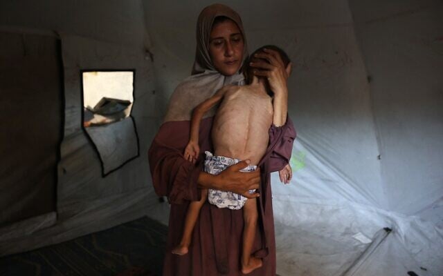 Hidaya, une mère palestinienne de 31 ans, berce son fils Mohammed al-Mutawaq, âgé de 18 mois et malade, qui présente également des signes de malnutrition, dans leur tente du camp de réfugiés d'Al-Shati, à l'ouest de Gaza-City, le 24 juillet 2025. (Crédit : Omar AL-QATTAA / AFP)