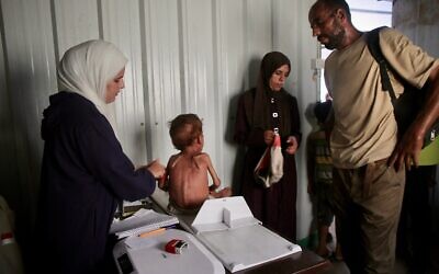 Un enfant palestinien souffrant de malnutrition est examiné dans un centre médical géré par une ONG locale affiliée aux services de santé primaires du ministère palestinien de la Santé à al-Mawasi, dans le sud de la bande de Gaza, le 13 août 2025. (Crédit : AFP)