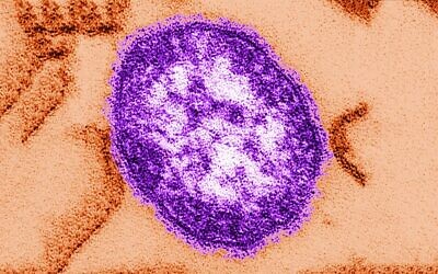 Le virus de la rougeole. (Crédit : Cynthia Goldsmith, Centres pour le contrôle et la prévention des maladies via AP)