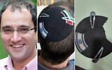 Alex Sinclair sur une photo non datée, ainsi que sa kippa avant et après la découpe du drapeau "palestinien", telle que photographiée le 23 avril 2026. (Crédit : Alex Sinclair)