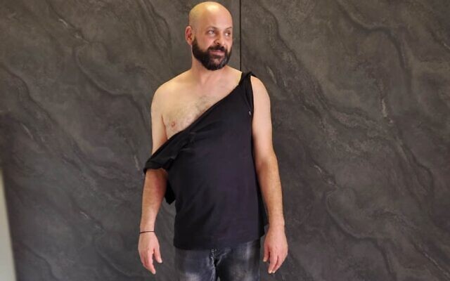 Issam Sharif, conseiller d'orientation à Kafr Yasif, affirme avoir été injustement arrêté et passé à tabac par la police le 15 mai 2026. (Crédit : Autorisation) Issam Sharif, conseiller d'orientation à Kafr Yasif, affirme avoir été injustement arrêté et passé à tabac par la police le 15 mai 2026. (Crédit : Autorisation)