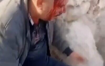 Un Palestinien blessé par des résidents d'implantations en Cisjordanie le 8 mai 2026. (Capture d'écran : X, utilisée conformément à l'article 27a de la loi sur le droit d'auteur)