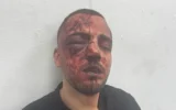 Un procureur arabe israélien du parquet du district sud qui aurait été agressé par des policiers à Beer Sheva le 3 mai 2026. (Crédit : utilisé conformément à l’article 27a de la loi sur le droit d’auteur)