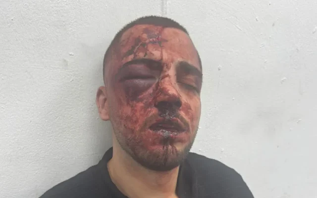 Un procureur arabe israélien du parquet du district sud qui aurait été agressé par des policiers à Beer Sheva le 3 mai 2026. (Crédit : utilisé conformément à l’article 27a de la loi sur le droit d’auteur)
