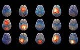 La start-up israélienne Hemispheric, spécialisée dans la neuro-IA, développe un modèle d'IA pour déchiffrer le langage du cerveau. (Crédit : David Garb)