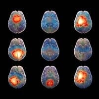 La start-up israélienne Hemispheric, spécialisée dans la neuro-IA, développe un modèle d'IA pour déchiffrer le langage du cerveau. (Crédit : David Garb)