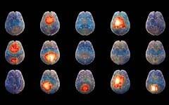 La start-up israélienne Hemispheric, spécialisée dans la neuro-IA, développe un modèle d'IA pour déchiffrer le langage du cerveau. (Crédit : David Garb)