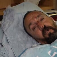 Khaled Asiwat, un chauffeur de bus qui a été agressé à Beit Shemesh le 30 août 2026, s'exprimant au sujet de cette agression sur la chaîne publique Kan. (Crédit : Capture d'écran)