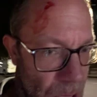 Une photo publiée par Dan Levene après avoir signalé avoir été agressé par des graffeurs anti-Israël, le 7 octobre 2026. (Crédit : Dan Levene/X)