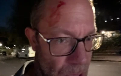 Une photo publiée par Dan Levene après avoir signalé avoir été agressé par des graffeurs anti-Israël, le 7 octobre 2026. (Crédit : Dan Levene/X)