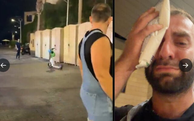 À gauche, des images de l’agression survenue au port de Jaffa, dans la nuit du 13 au 14 octobre 2026. À droite, la victime, Idan Trachtengerts, le visage blessé, une poche de glace sur l’œil. (Crédit : Alimut Israel/X)