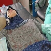 Une photo obtenue par l'armée israélienne et partagée par Emily Damari, ancienne otage du Hamas libérée, le 3 octobre 2026, la montre à l'hôpital Shifa de Gaza-City après avoir été enlevée et emmenée de force dans l'enclave côtière lors du pogrom perpétré par le Hamas le 7 octobre 2023 dans le sud d'Israël. (Armée israélienne via @emilydamari sur Instagram)