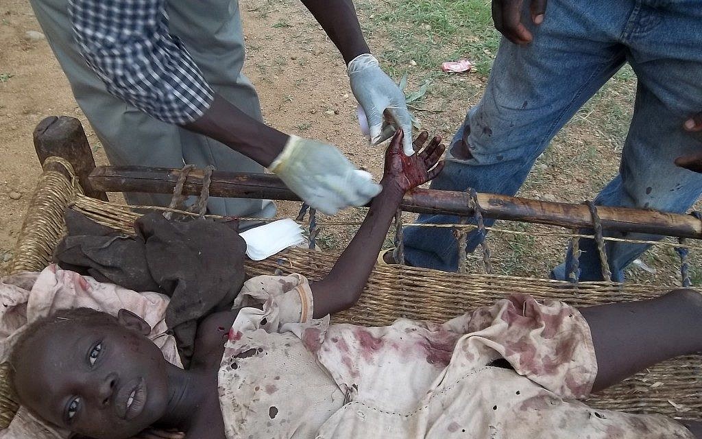 Sudanese girl injured by a government attack in South Kordofan (photo credit: Courtesy) Sudanese girl injured by a government attack in South Kordofan (photo credit: Courtesy)
