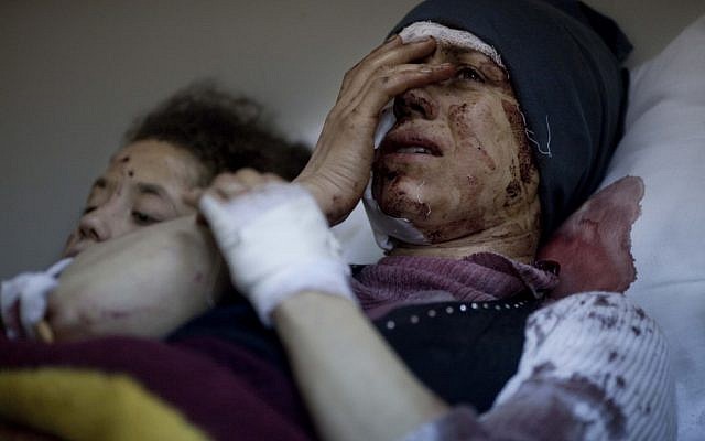 A Syrian woman recovers from severe injuries after the army shelled her house in Idlib, north Syria, on Saturday (photo credit: AP/Rodrigo Abd)