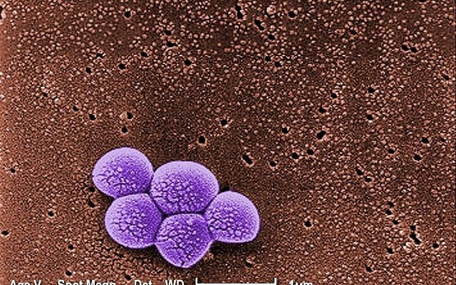 Magnified 20,000X, this colorized scanning electron micrograph (SEM) depicts a grouping of methicillin resistant Staphylococcus aureus (MRSA) bacteria. (Courtesy Janice Carr/Public Health Image Library PHIL) Magnified 20,000X, this colorized scanning electron micrograph (SEM) depicts a grouping of methicillin resistant Staphylococcus aureus (MRSA) bacteria. (Courtesy Janice Carr/Public Health Image Library PHIL)
