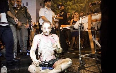 Moshe Silman set himself on fire and severely burned himself during a protest in Tel Aviv against the soaring costs of living on July 14, 2012. Silman died eight days later. (Photo credit: Tali Mayer/Flash90)