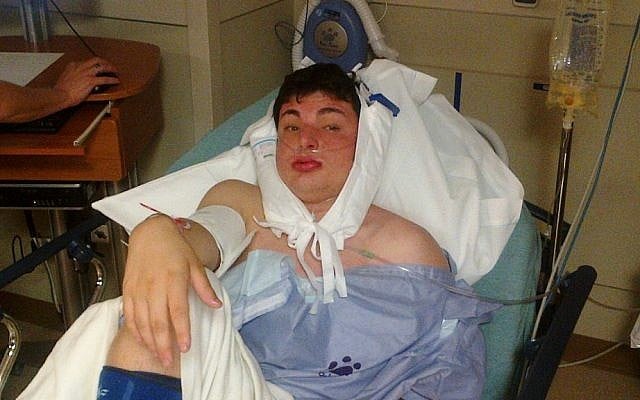 Zach Tennen, a 19-year-old student at Michigan State University in East Lansing, recovering from an attack at an off-campus party early Sunday morning (AP photo provided by Bruce Tennen). Zach Tennen, a 19-year-old student at Michigan State University in East Lansing, recovering from an attack at an off-campus party early Sunday morning (AP photo provided by Bruce Tennen).