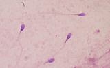 Illustrative photo of human sperm (photo credit: CC BY-SA 2.0 Bobjgalindo/Wikimedia)