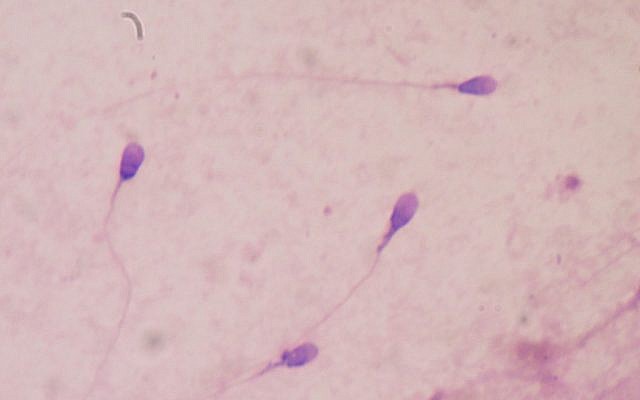 Illustrative photo of human sperm (photo credit: CC BY-SA 2.0 Bobjgalindo/Wikimedia)