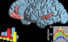 The two language areas where cell reactions during speech were researched. The graphs present a selective code for vowels in an area in the frontal lobe and a non-selective code in an area in the temporal lobe. Each color represents a neuron (Photo credit: Ariel Tankus)