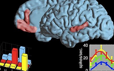 The two language areas where cell reactions during speech were researched. The graphs present a selective code for vowels in an area in the frontal lobe and a non-selective code in an area in the temporal lobe. Each color represents a neuron (Photo credit: Ariel Tankus)