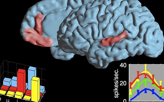 The two language areas where cell reactions during speech were researched. The graphs present a selective code for vowels in an area in the frontal lobe and a non-selective code in an area in the temporal lobe. Each color represents a neuron (Photo credit: Ariel Tankus) The two language areas where cell reactions during speech were researched. The graphs present a selective code for vowels in an area in the frontal lobe and a non-selective code in an area in the temporal lobe. Each color represents a neuron (Photo credit: Ariel Tankus)