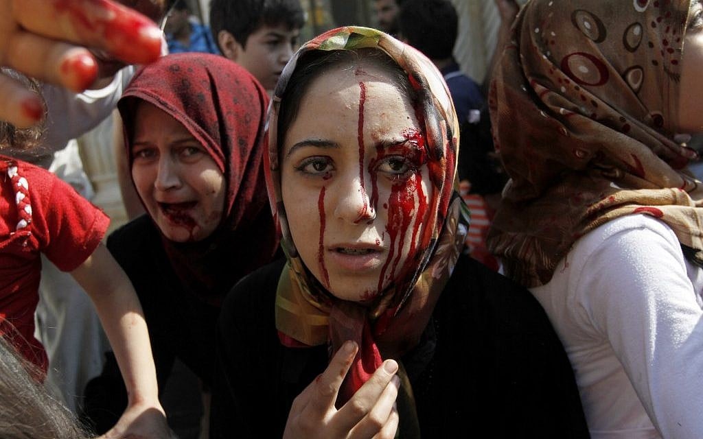 Injured Syrian women arrive at a field hospital after an air strike hit their homes in the town of Azaz on the outskirts of Aleppo, Syria, last month (Illustrative photo credit: AP Photo/ Khalil Hamra)