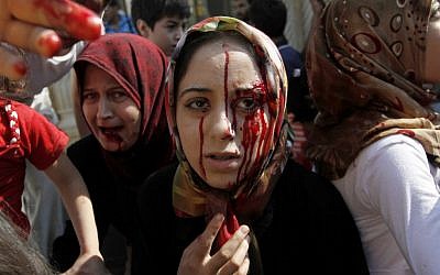 Injured Syrian women arrive at a field hospital after an air strike hit their homes in the town of Azaz on the outskirts of Aleppo, Syria, last month (Illustrative photo credit: AP Photo/ Khalil Hamra)