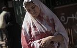 In this Thursday, Sept. 20, 2012 photo, a wounded woman, still in shock, leaves Dar El Shifa hospital in Aleppo, Syria. (AP Photo/ Manu Brabo)