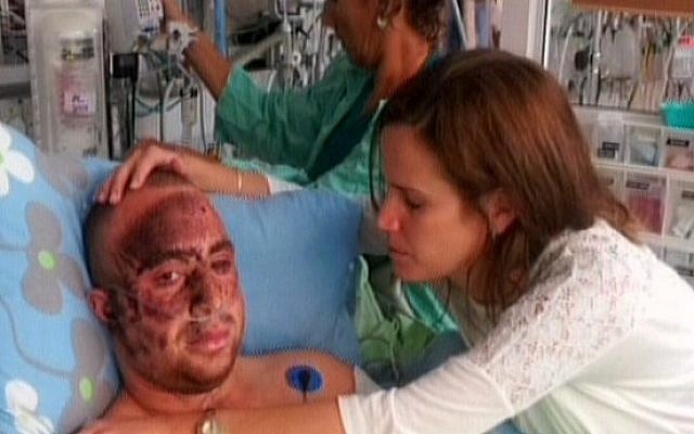 Capt. Ziv Shilon, who lost an arm in a Gaza border bombing, recovers in hospital (photo credit: image capture from Channel 10)