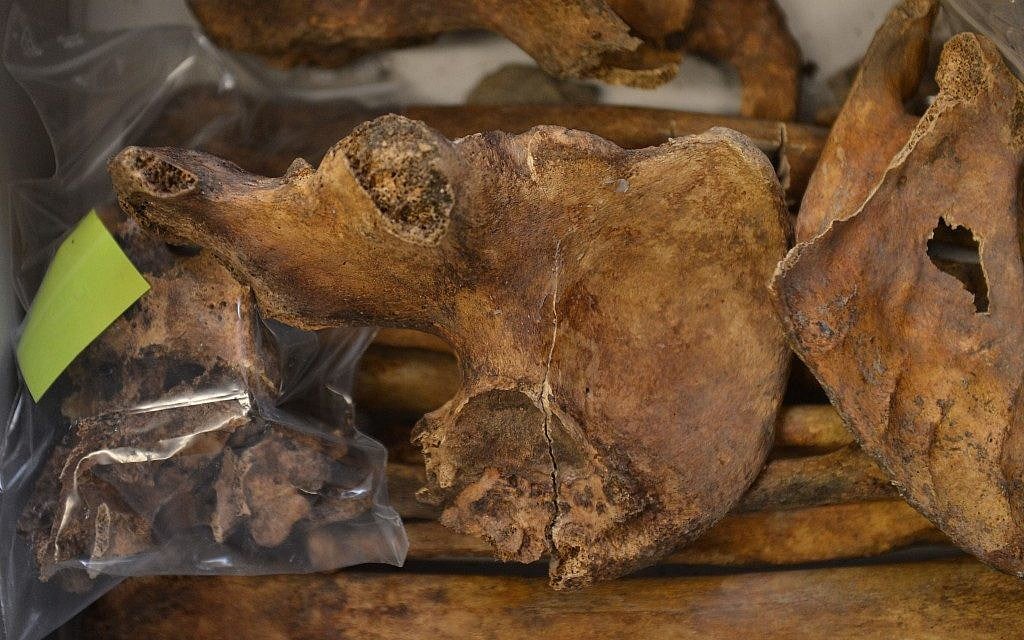 Bones recovered from a cemetery near Innsbruck, Austria, reveal that Nazi-era psychiatric patients were demeaned, starved, brutalized, and left to die. (Kerstin Joensson/AP) Bones recovered from a cemetery near Innsbruck, Austria, reveal that Nazi-era psychiatric patients were demeaned, starved, brutalized, and left to die. (Kerstin Joensson/AP)