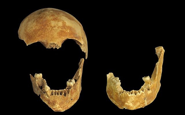 Skeletal remains found at the bottom of an 8,500-year-old well in the Jezreel Valley (photo credit: Clara Amit, courtesy of the Israel Antiquities Authority)