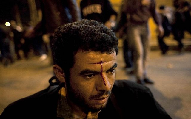 An injured Egyptian anti-government protester waits for medical care during clashes between supporters of president Mohammed Morsi and their rivals in front of the president palace, in Cairo, Egypt, Wednesday, Dec. 5, 2012 (photo credit: AP/Nasser Nasser)
