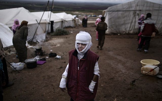 Abdullah Ahmed, 10, who suffered burns in a Syrian government airstrike and fled his home with his family, stands outside their tent at a camp for displaced Syrians in the village of Atmeh, Syria, on Tuesday, December 11, 2012. (photo credit: Muhammed Muheisen/AP)
