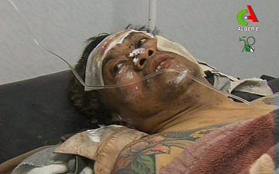 An unidentified rescued hostage receives treatment in a hospital in Ain Amenas, Algeria, Friday. (AP Photo/Canal Algerie via Assiaciated Press TV)