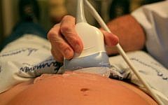 Illustrative: A pregnant woman gets an ultrasound checkup. (Shay Levy/Flash90)