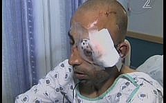 Injured Tel Aviv municipal worker Hassan Ausruf (photo credit: screenshot Channel 2)