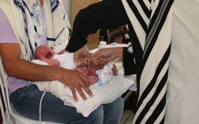A circumcision performed at home. (photo credit: courtesy)