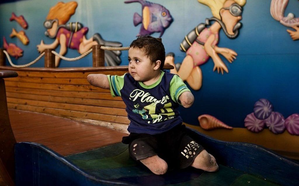 Palestinian child Mohammed al-Farra is seen at the Tel Hashomer Hospital near Ramat Gan, central Israel, on Monday. (photo credit: AP/Dan Balilty) Palestinian child Mohammed al-Farra is seen at the Tel Hashomer Hospital near Ramat Gan, central Israel, on Monday. (photo credit: AP/Dan Balilty)